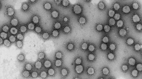 coronavirus opt