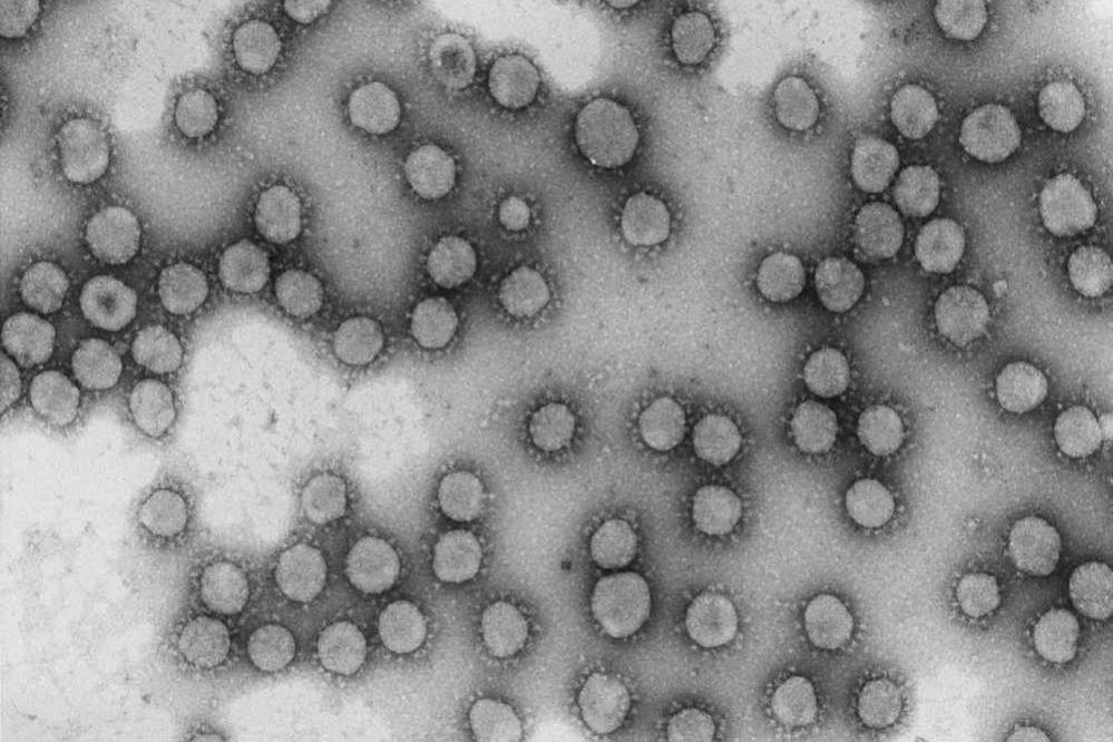 coronavirus opt