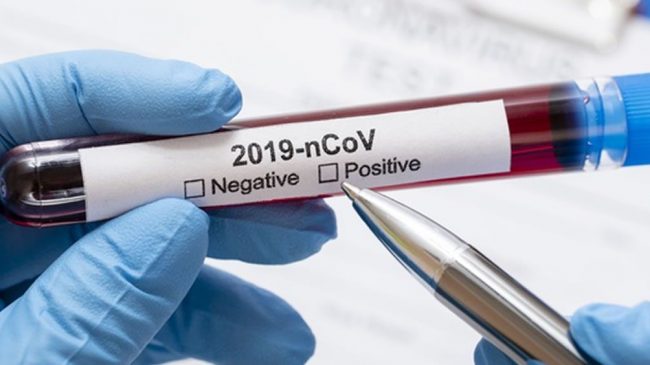 coronavirus-foto-freepik