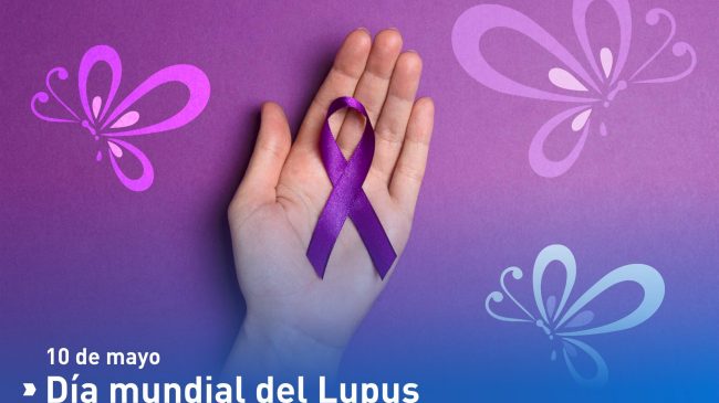 10-DE-MAYO-DIA-MUNDIAL-DEL-LUPUS-2022-scaled-1