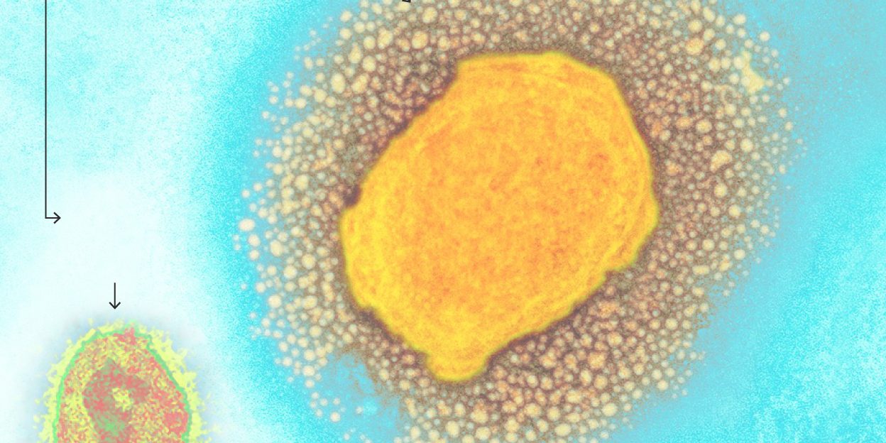 viruelamono 1-M